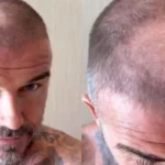 David Beckham Mencukur Tambalan Botak karena Kesalahan Victoria Reaksi Sang Istri Bikin Publik Terpingkal
