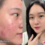 bahan dapur untuk luka