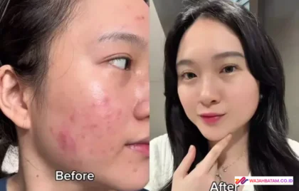 bahan dapur untuk luka